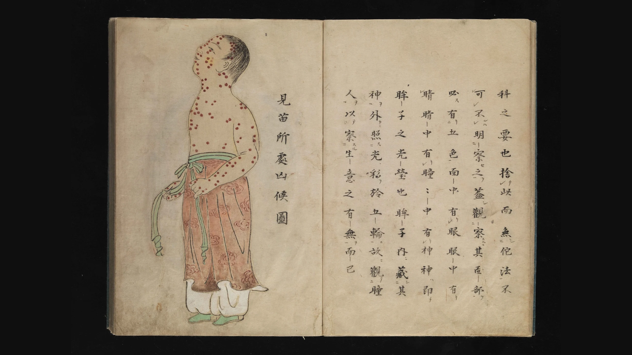 TN x IshitaWellcome Library, London via Wikimedia Commons Smallpox illustration, Japanese manuscript, c. 1720. (20)