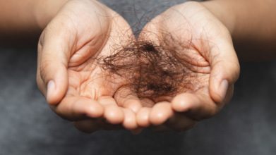 Ozempic Hair Loss (Credit - Canva)