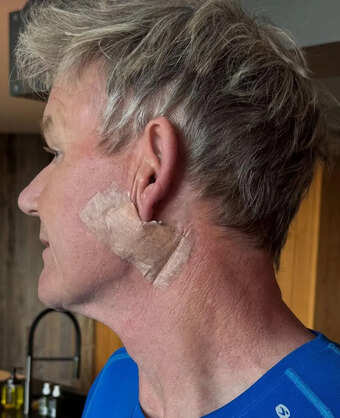 Celebrity Chef Gordon Ramsay Reveals Skin Cancer Diagnosis