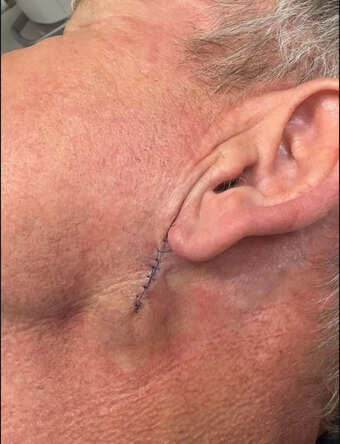 Celebrity Chef Gordon Ramsay Reveals Skin Cancer Diagnosis