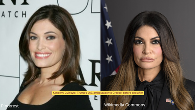 What is Mar-a-Lago Face?