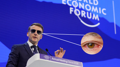 What Happened to Emmanuel Macron's Eyes?