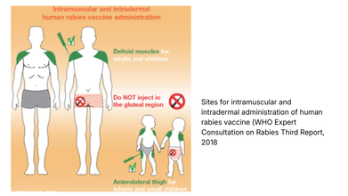 Sites for intramuscular and intradermal administration of human rabies vaccine (WHO Expert Consultation on Rabies Third Report, 2018