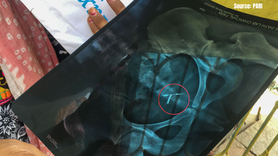 Romanticization And The Silent Dismissal Of Women’s Pain | Women's Day Special