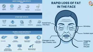 India To Strictly Inspect GLP-1 Drugs To Curb Misuse: Govt Flags Risks Amid Weight-loss Hype