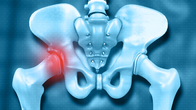 Hip Fracture After 65: Why It Can Be Life-Threatening? Experts Explain How to Prevent