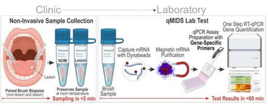 New Painless Brush Test Detects Oral Cancer In Just 60 Minutes With Over 90% Accuracy