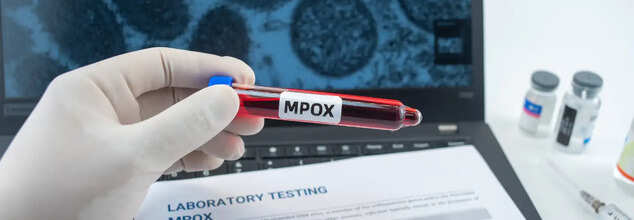 Mpox