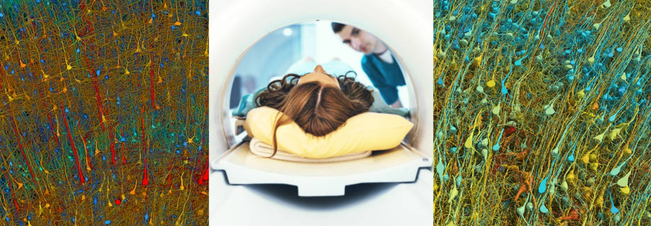 Google And Harvard Collaborate To Create The Most Detailed Human Brain ...