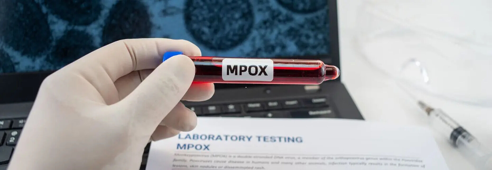 Mpox Epicenter DRC To Receive Mpox Vaccine, Vaccination To Begin Next ...
