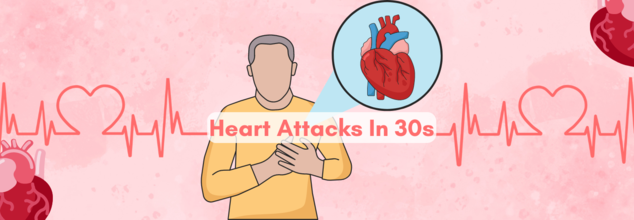 Heart Attacks In 30s