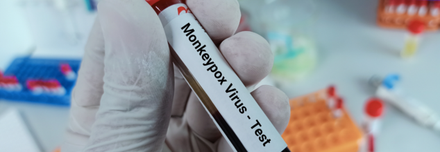 Mpox Virus in US Prison