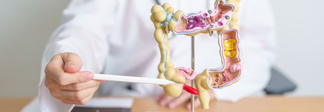 Colon Cancer