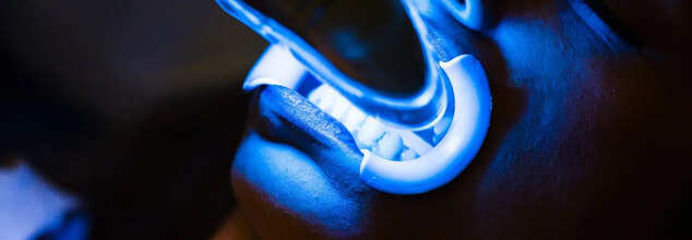 dental procedure