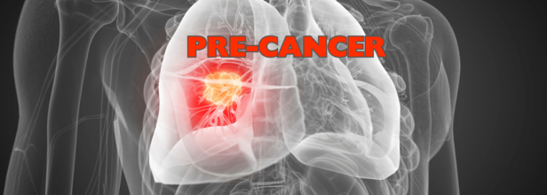 Does pre-cancer mean I’m going to get cancer? (Credit: Canva)