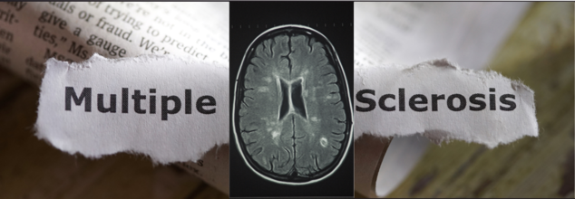 Multiple Sclerosis