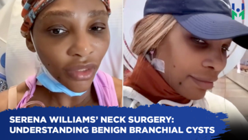 Serena Williams’ neck surgery: Understanding benign branchial cysts