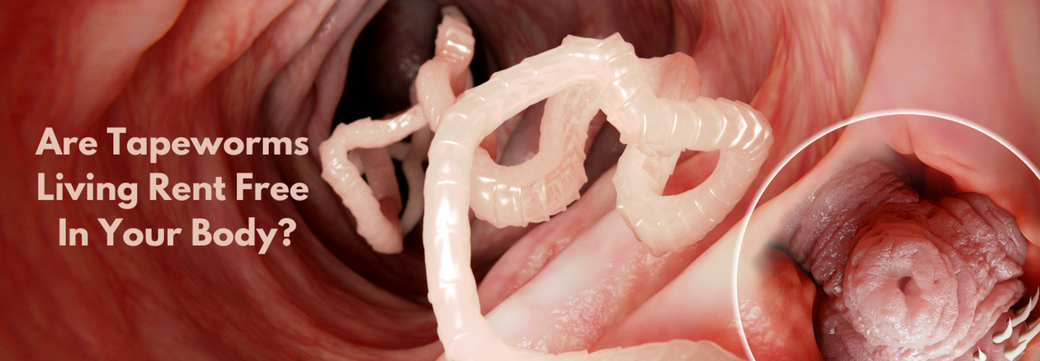 Are Tapeworms Living Rent Free In Your Body? Health and Me