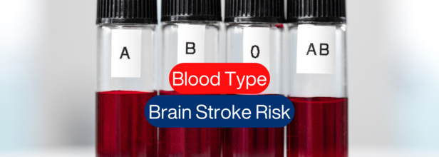 Are You At Risk For Early Stroke? Your Blood Type Could Hold The Answer