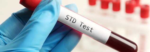 STD