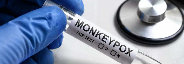 Monkeypox