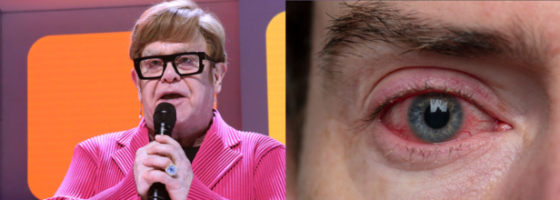 Elton John experiences vision loss due to eye infection