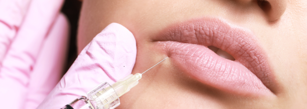 How long do lip fillers last for?
