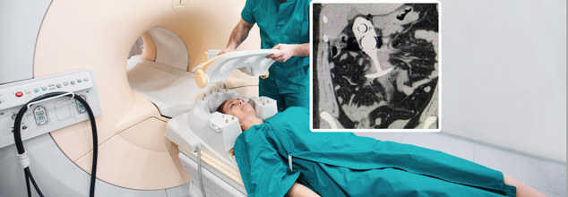 Woman Left Screaming In Pain After Sex Toy 'Pulled Through Body' During MRI Scan