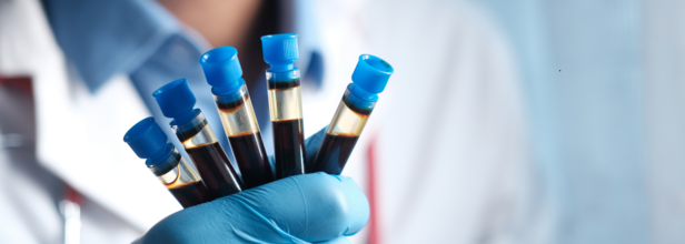 Blood Test For Colon Cancer