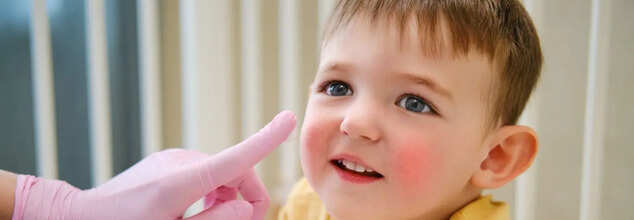 Dead Sea Salt May Soothe Eczema: How To Use It
