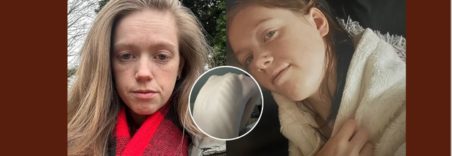 'I Vomit Everything I Eat', Health Worker Narrates Her Suffering- A Condition That Feels Like Choking Every Time You Eat