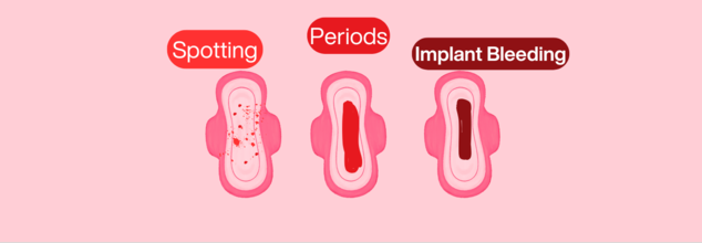 Spotting vs Period vs Bleeding: How To Identify