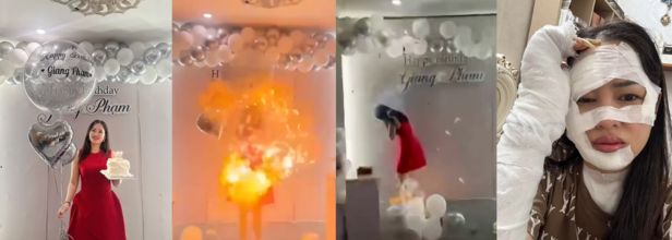 Giang Pham's birthday celebrations gone wrong with hydrogen balloon exploding on her face and hand