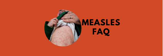 Measles FAQs: What You Must Know About The Disease