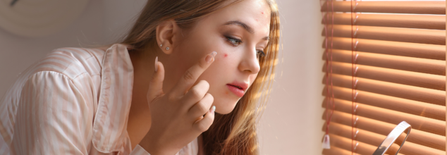 Dermatologists Share 9 'Quick Fix' To Try When Acne Won’t Clear