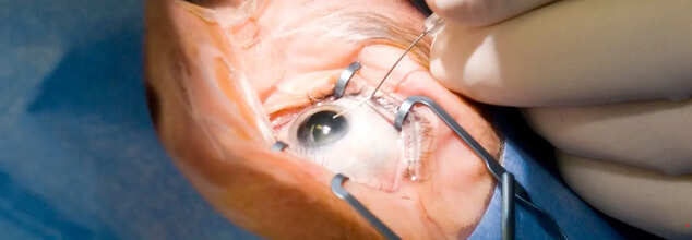 Surgeons In Canada Implant Man's Tooth In His Eye To Restore Vision-Here's How It Works