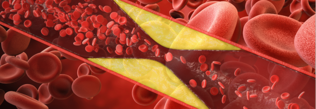 You Have Heard Of Blood Thinning, But Do You Know Blood Thickening Can Also Make You Sick?