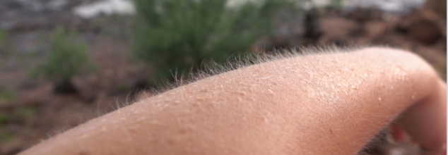 Goosebumps Aren’t Just About Cold, Then What Are They?