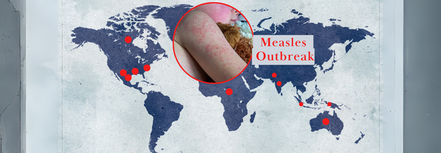 Not Just In US, Measles Outbreak Is Growing Even Across The World- Is It Time To Get Booster Shot?