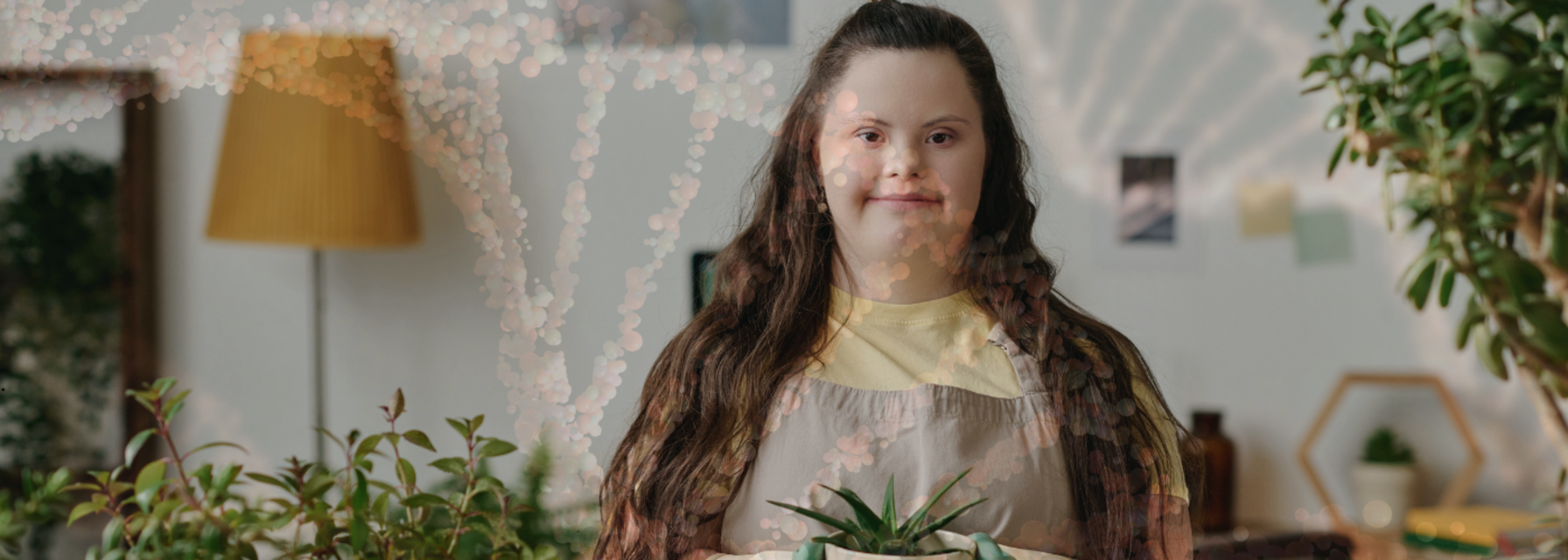 WHAT CAUSES DOWN SYNDROME TO OCCUR visual data 2