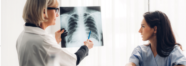 TB cases rise in the US