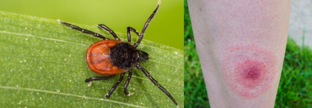 Lyme Disease’s ‘Achilles’ Heel’ Discovered- Could The Bacteria Itself Be Used For Treatment?