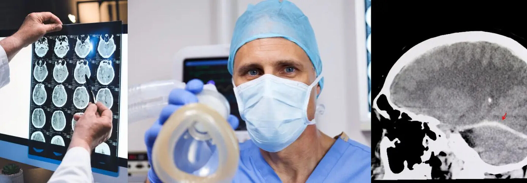 Boom Strikes: Why Are Cases Of Head Injuries Among Anesthesiologists ...