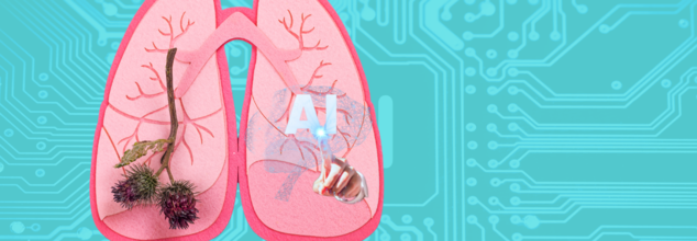 AI Tool Can Detect Lung Cancer Early By Analyzing Your Voice: Turkish Scientists