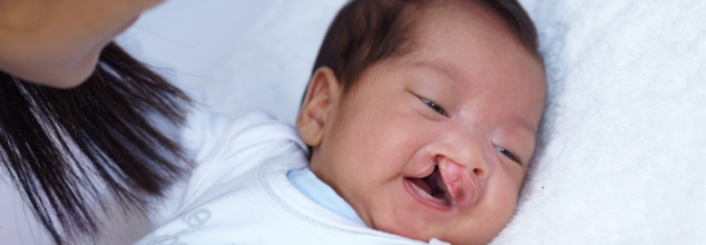 If it necessary to get a cleft lip surgery?