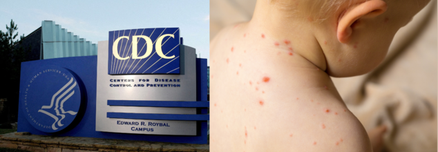 New Possible Measles Exposure Hits Austin Weeks After CDC Buried Forecast Stressing Need For Vaccinations