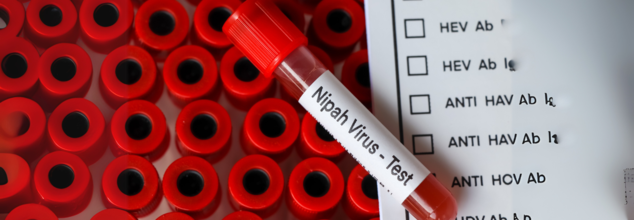Kerala Reports New Nipah Virus Case As Woman Tests Positive; Know The Fatal Symptoms Of This Zoonotic Infection?