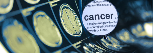 Cancer Before Age 50 Is On The Rise, New Study Lists Which Types