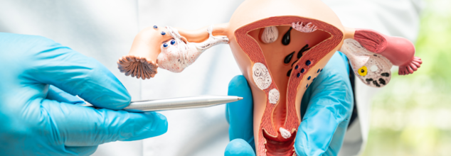 Cervical Cancer home test