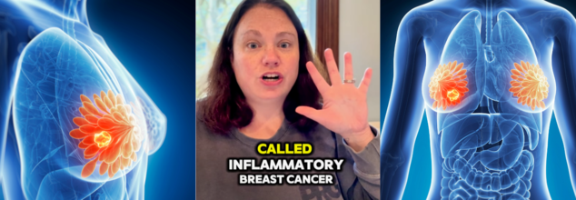 Real Life Story: How A Rash On Boob Turned Into A Rare Form Of Breast Cancer